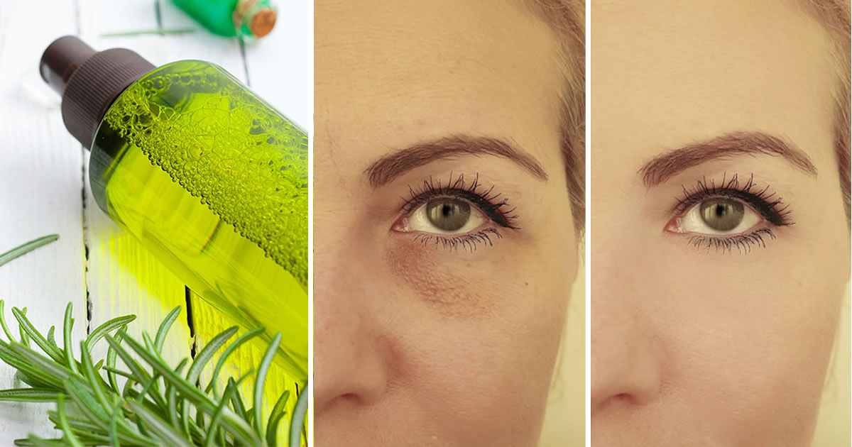 *Tonico al rosmarino contro rughe e macchie per ringiovanire di 10 anni